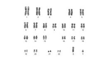 由于过程中在减数分裂ii期发生y染色体不分离,使部分精子含有两条y