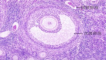 原始卵泡的图片_排卵期卵泡b超图片_卵泡破裂图片