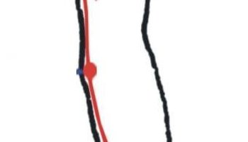 腕骨