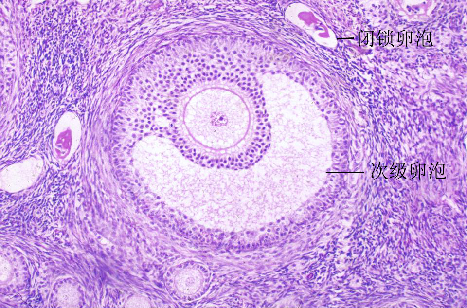卵泡(folliole)卵巢皮质内由一个卵母细胞和其周围许多小型卵泡细胞所