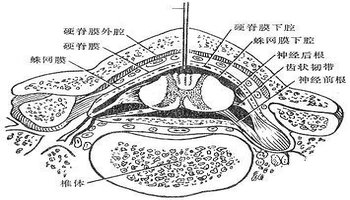 蛛网膜下腔图片解剖图片